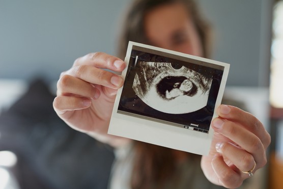 woman showing her 12-week pregnancy scan to the camera