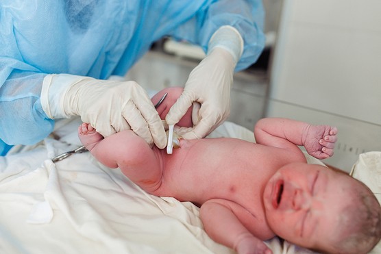 crying newborn baby with doctor wearing gloves clamping umbilical cord